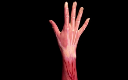 Bandimplantate weben